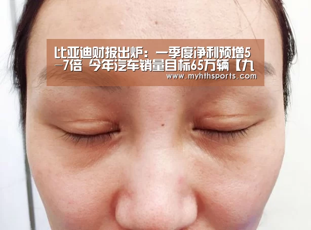 比亚迪财报出炉:一季度净利预增5-7倍 今年汽车销量目标65万辆【九游彩票】(图1) 九游棋牌官网